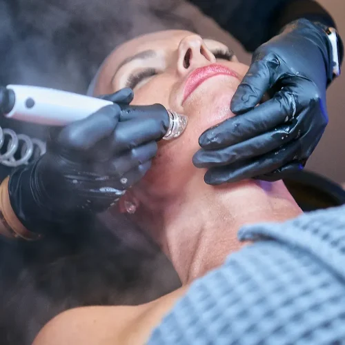 Exosome Facial-sc-story-1080-1920-1-1-square