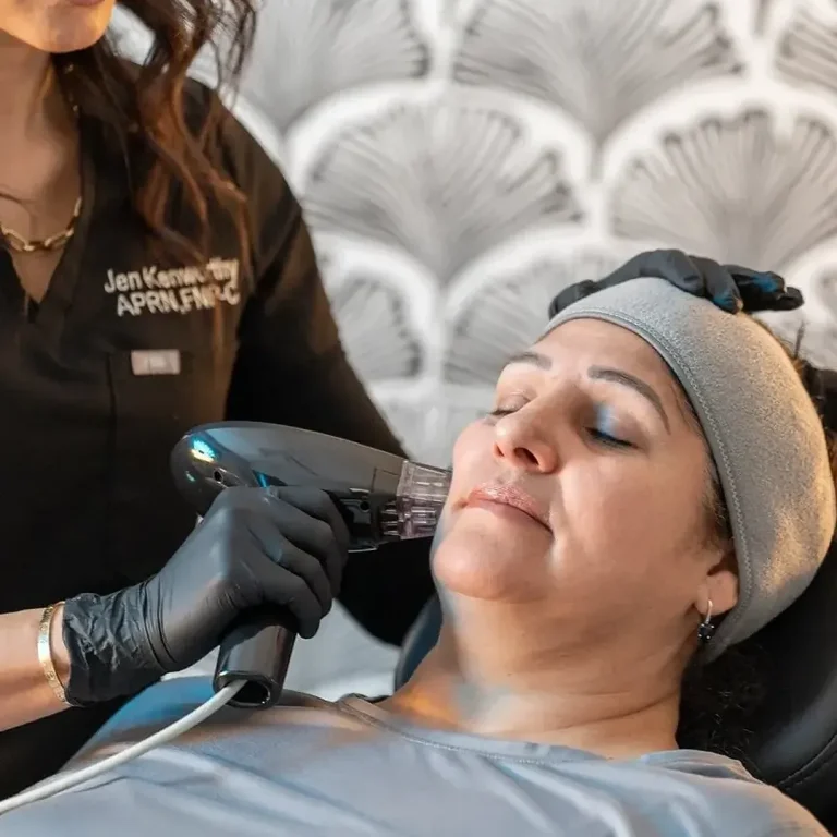 Morpheus8 RF Microneedling(1)-sc-story-1080-1920-1-1-square